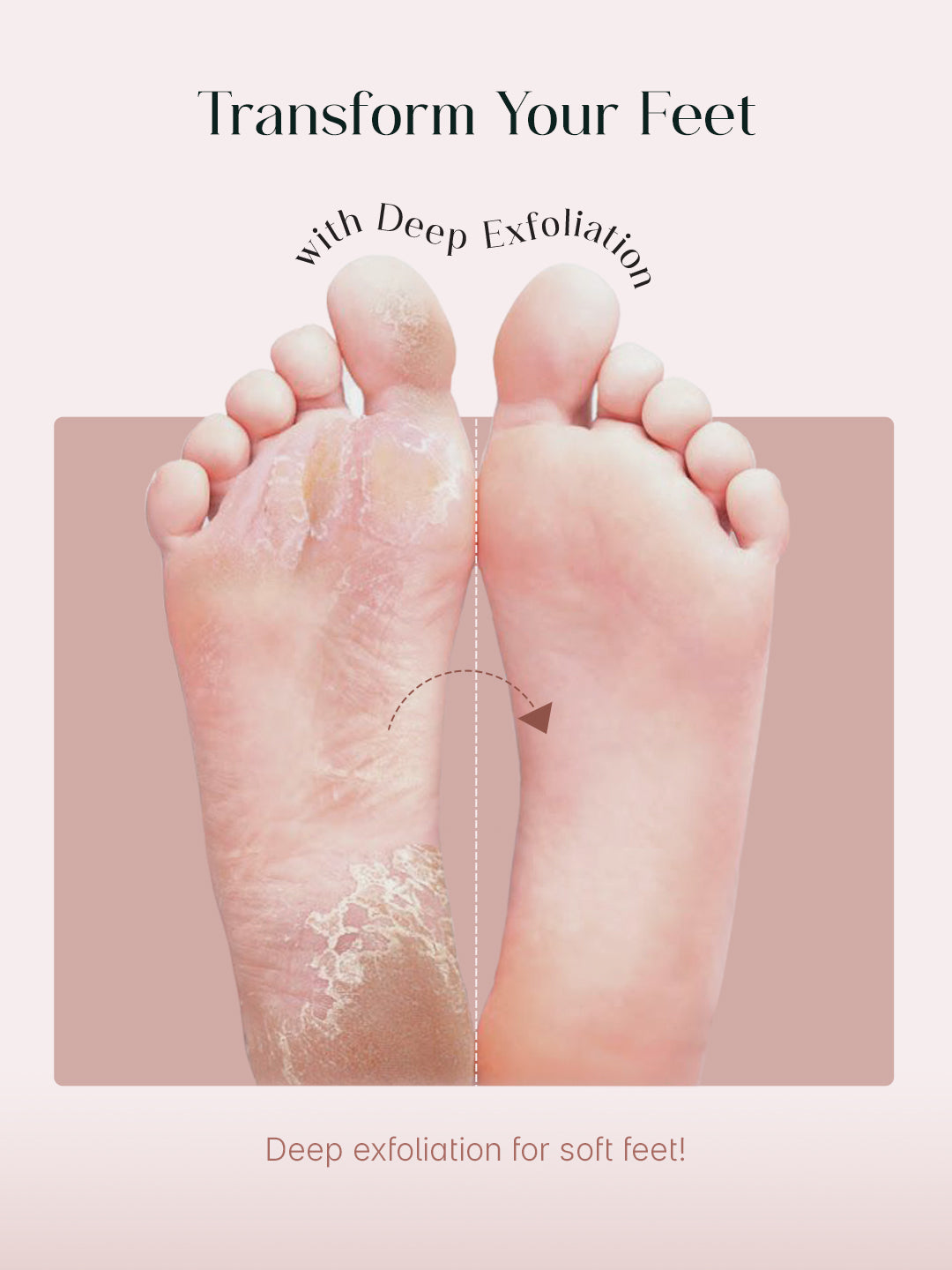 SeoulSkin™ SmoothPeel Foot Mask | BOGO Offer