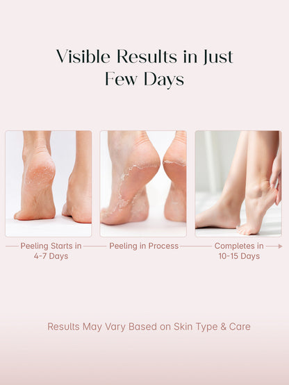 SeoulSkin™ SmoothPeel Foot Mask | BOGO Offer